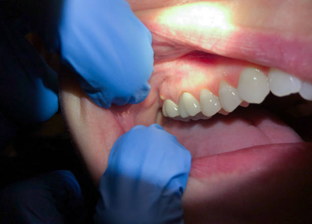 Best After-Hours Dental Trauma Care in Mason, TX